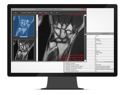 ORPALIS GdPictureNET DICOM plugin (техподдержка на 1 год), 6 разработчиков